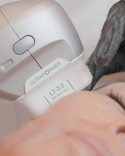 Ultraformer facial dau estetica Ultraformer facial dau estetica