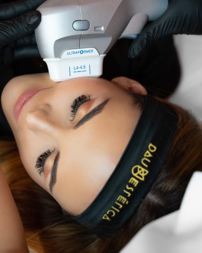 Ultraformer facial majadahonda Ultraformer facial majadahonda