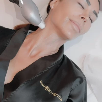 Ultraformer Dau estetica